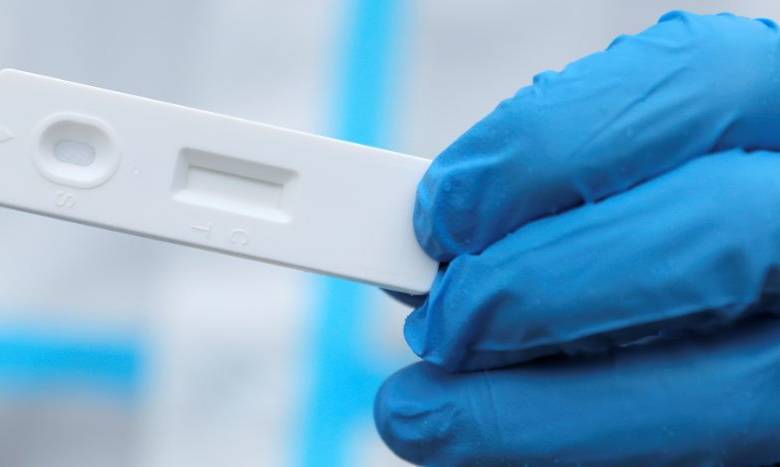 Aprueban en Estados Unidos el primer kit de prueba casero de Covid-19 1 Aprueban en Estados Unidos el primer kit de prueba casero de Covid-19