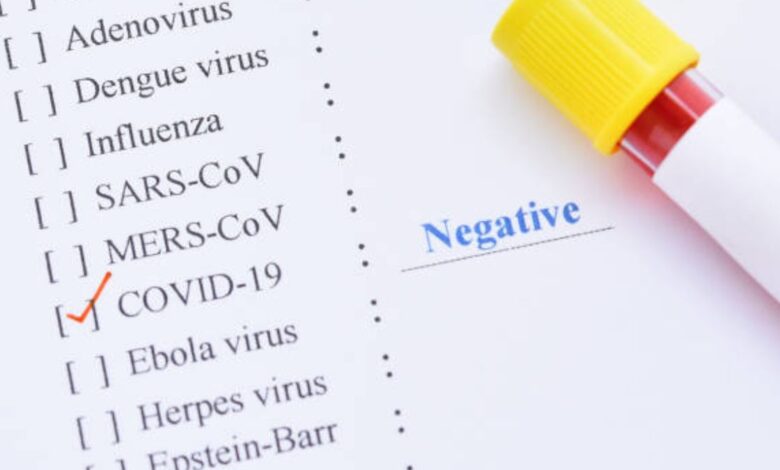 ¿Cómo terminará la pandemia de Covid-19? Así opinan los expertos 1 ¿Como terminara la pandemia de Covid 19 Asi opinan los expertos