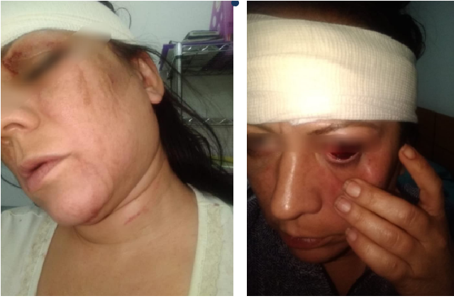 Policía golpea salvajemente a su esposa, detenido por intento de feminicidio, en Querétaro 1 Policía golpea salvajemente a su esposa, detenido por intento de feminicidio, en Querétaro