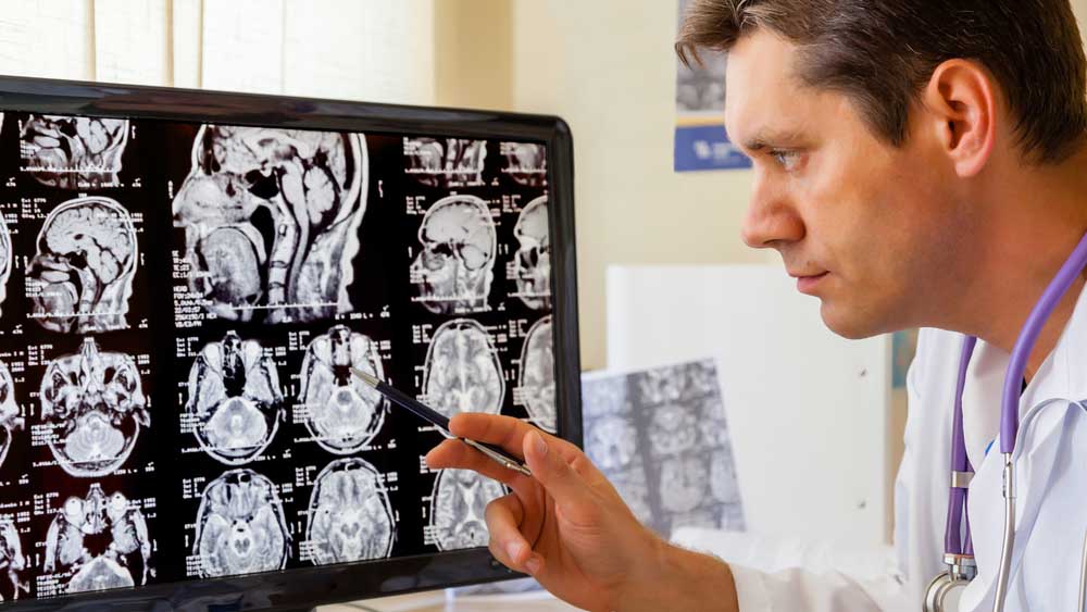 ¿Grabarse el cuello con el teléfono? El video que te alertaría del riesgo de un derrame cerebral, según estudio 1 ¿Grabarse el cuello con el telefono El video que te