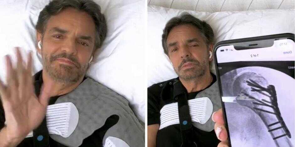 Eugenio Derbez reaparece y da detalles de su estado de salud tras accidente 2 derbez
