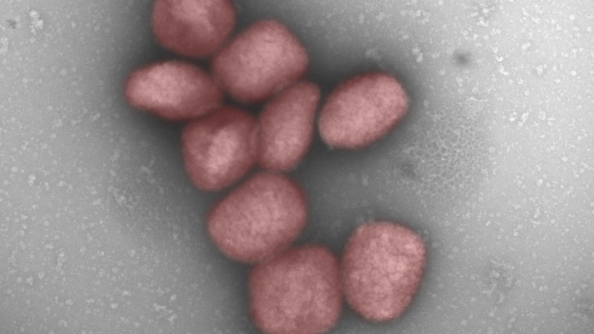 El virus de la viruela del mono podría transmitirse también por vía aérea 1 El virus de la viruela del mono podria transmitirse tambien