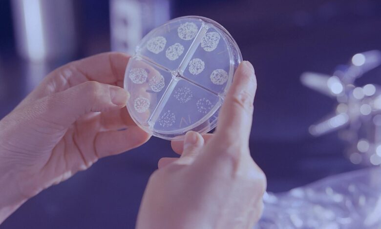 El objeto de tu casa que puede acumular 33:000 bacterias: aprende a limpiarlo 1 El objeto de tu casa que puede acumular 33000 bacterias