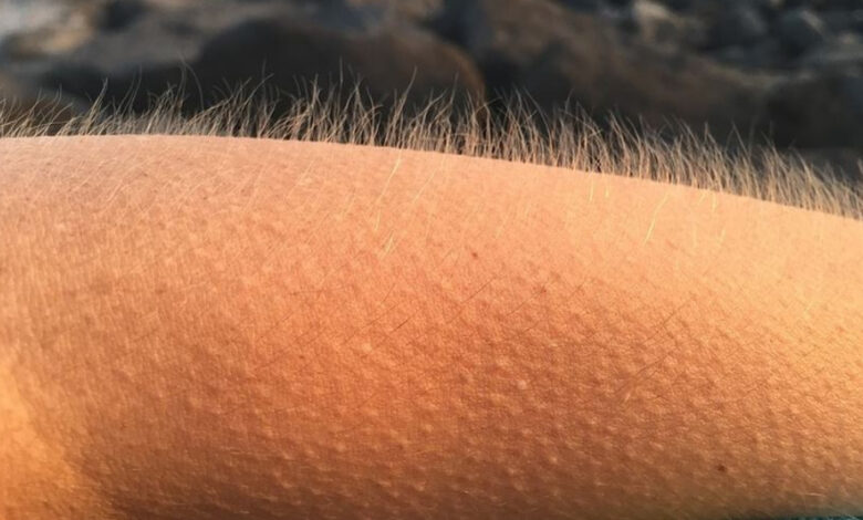 La razón por la que se nos pone la piel de gallina en determinados momentos 1 La razon por la que se nos pone la piel